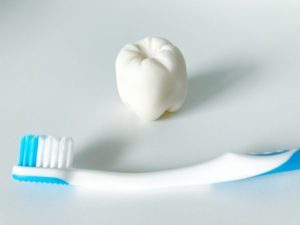 インプラントと静脈内鎮静法(IVS)